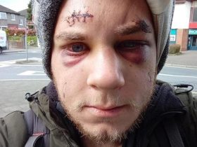 两男在这英语国家因讲“外语”惹祸,被指欠尊重遭围殴1死1重伤