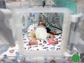 早产婴睡保温箱遭遗留消毒湿纸巾灼伤留疤，家属获赔32万欧元