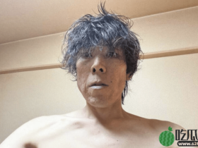 酗酒毁身体,47岁日本网红只剩一年寿命,巨肚照震撼网民